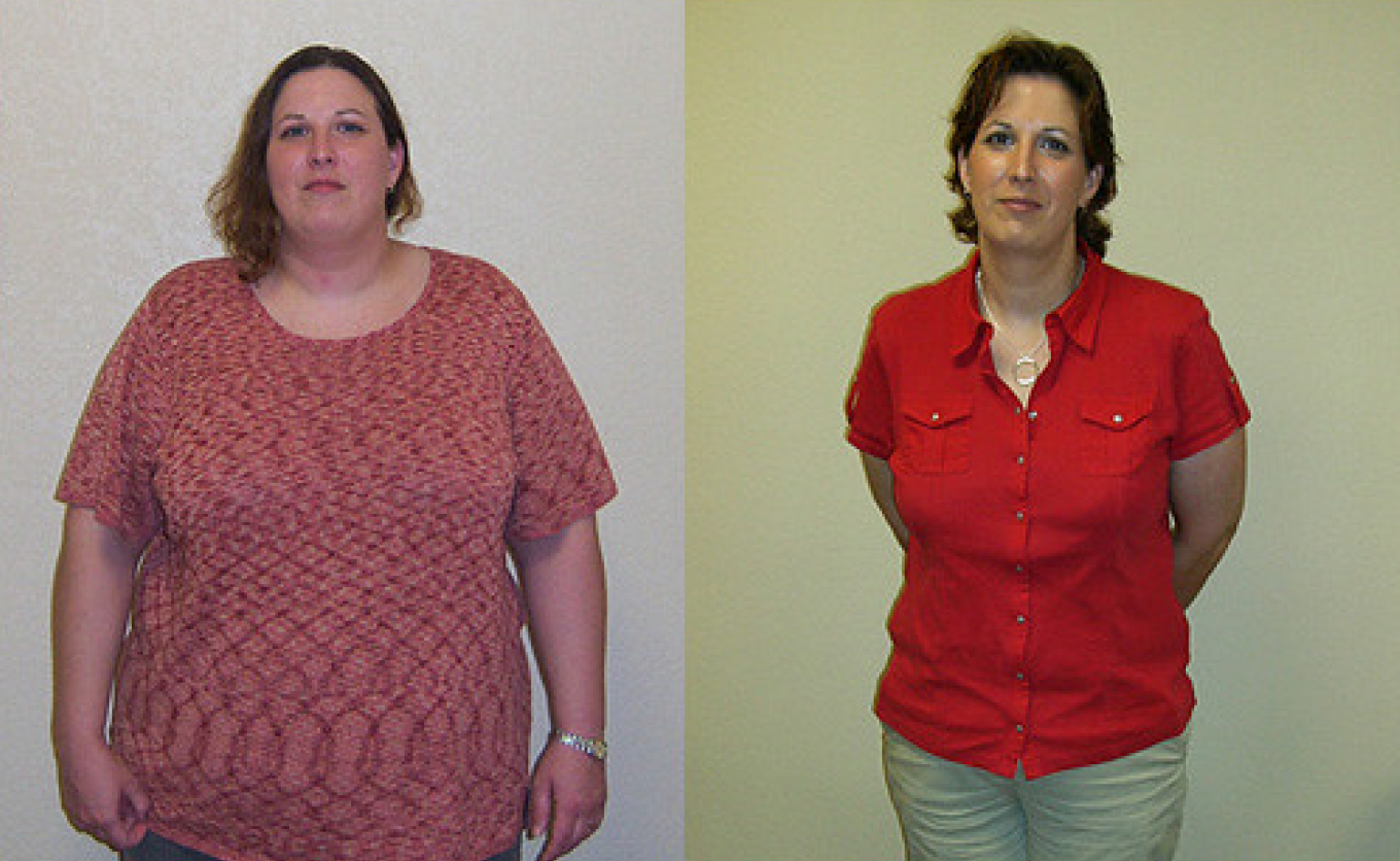 Weight Loss Fort Myers